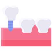 dental-implant-1